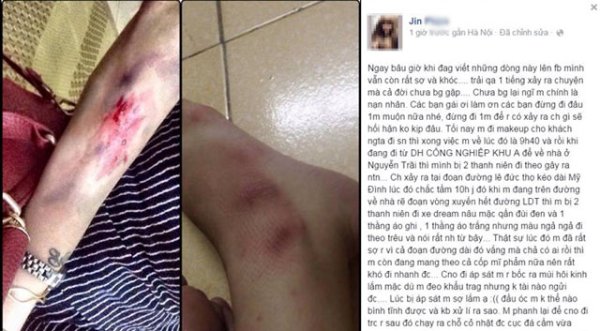 Cô gái trẻ dựng chuyện bị 2 thanh niên tấn công trong đêm