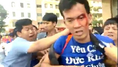 Côn đồ tấn công thanh niên tại chung cư cao cấp giữa Sài Gòn