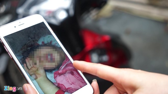 Chị Nguyễn chia sẻ hình ảnh con gái vật vã, khóc trong hoảng loạn và kêu cứu hàng đêm. Ảnh: 