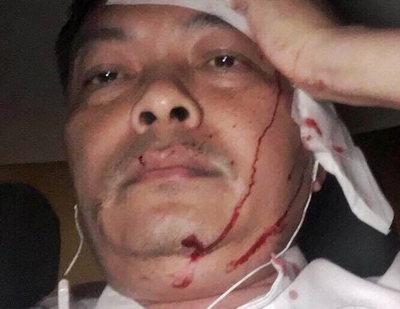 Giám đốc nhân sự cà phê Trung Nguyên bất ngờ bị tấn công nhập viện