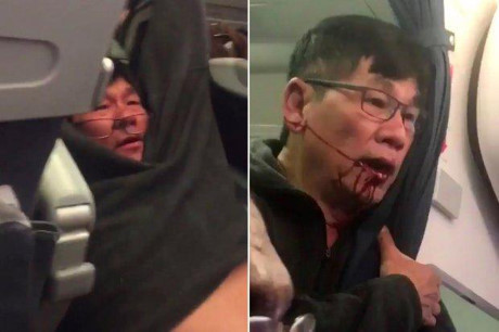 Bác sĩ gốc Việt David Dao bị các nhân viên an ninh dùng vũ lực kéo ra khỏi máy bay vì từ chối nhường chỗ ngồi.