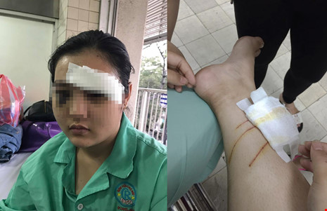 Cô gái trẻ nhập viện vì bị côn đồ hành hung, cắt tai