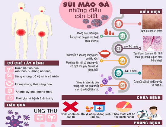 Infographic: Những điều cần biết về bệnh sùi mào gà