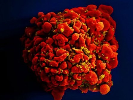 Tin vui: Thêm ca nhiễm virus HIV được chữa khỏi hoàn toàn
