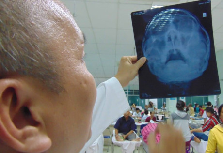 Bác sĩ Lê Hồng Hải đang xem kết quả chụp X quang của công S. Ảnh: TRẦN NGỌC
