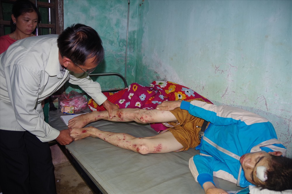 Bác sỹ Lường Văn Khoa, trạm trưởng trạm y tế xã Đồng Ruộng thăm khám cho nạn nhân bị lũ cuốn là Hà Văn Luân.