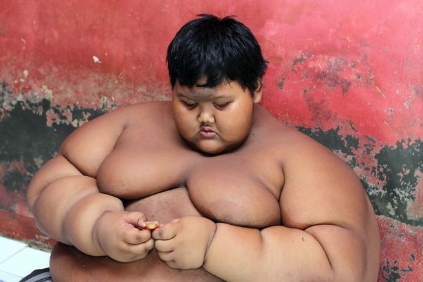 Cậu bé béo nhất thế giới nặng gần 2 tạ 'đổi đời' vì giảm cân