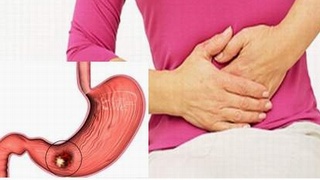 Bạn có phải là người có thể bị mắc ung thư dạ dày?