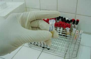 Tăng cường kiểm tra chất lượng xét nghiệm tại các bệnh viện
