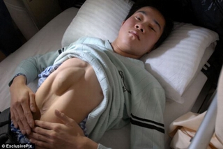 Chàng trai có tim ở bụng