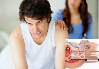 Bí quyết phòng tránh ung thư tuyến tiền liệt