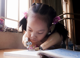 Kết nối ước mơ với bé gái không tay không chân