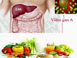 Ai dễ mắc bệnh viêm gan A?