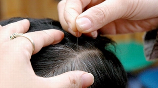Ăn đường và muối quá nhiều dễ gây bạc tóc