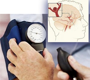 Tăng huyết áp: &quot;Kẻ thù&quot; âm thầm gây chết người