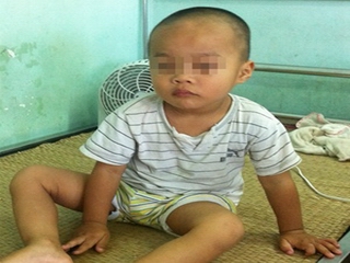 Xoắn tinh hoàn gây ảnh hưởng đến sinh sản