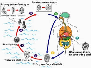 Ăn loại cua tôm nào dễ bị nhiễm sán lá phổi?