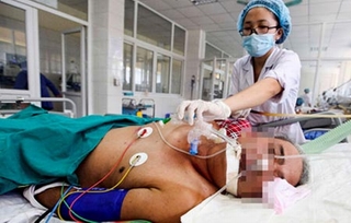Nguy cơ mắc bệnh giun xoắn vì ăn thịt sống
