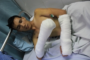 Nửa đêm, côn đồ xông vào phòng trọ truy sát người vô tội