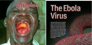 Việt Nam chưa ghi nhận ca bệnh do vi rút Ebola