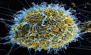 Dịch Ebola chưa dừng lại ở 4000 người chết