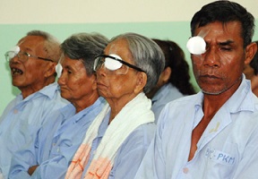 Thủ phạm gây bệnh đục thủy tinh thể
