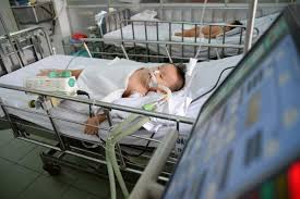 Trẻ em cũng bị xuất huyết não