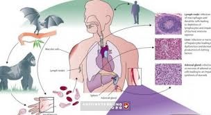 Hướng dẫn chẩn đoán, điều trị bệnh do vi rút Ebola