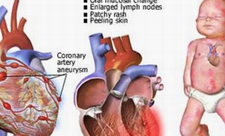 30% trẻ mắc bệnh hiếm gặp tử vong trước 5 tuổi