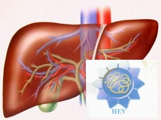 Bệnh viêm gan E &quot;đe dọa&quot; những ai?