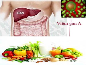 Dấu hiệu có thể bạn mắc bệnh viêm gan A