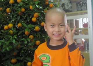 Lần đầu tiên thay tĩnh mạch chủ dưới cho trẻ ung thư