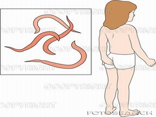 Cảnh giác trẻ gái viêm vùng kín do nhiễm giun kim