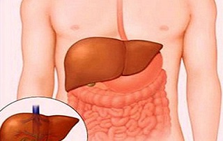 Khoảng 1 triệu người chết do bệnh viêm gan B mỗi năm
