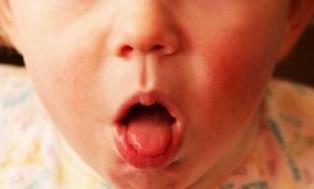 Bệnh ho gà có thể đe dọa tính mạng của trẻ