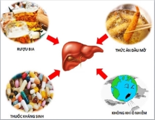 Gan nhiễm mỡ có chữa khỏi được không?