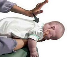 Cách sơ cứu khi trẻ bị sặc cháo