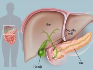 Viêm tụy cấp có thể gây tử vong