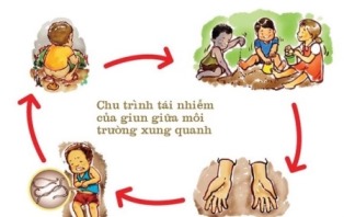 Dấu hiệu trẻ bị nhiễm giun sán