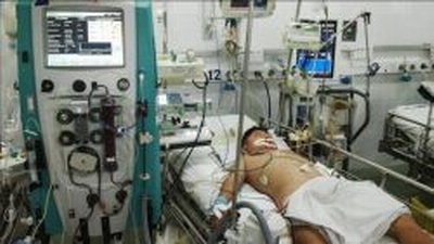 Thêm một trẻ sốc sốt xuất huyết nặng được cứu sống