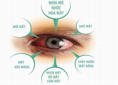 Dấu hiệu cảnh báo bệnh mắt nguy hiểm