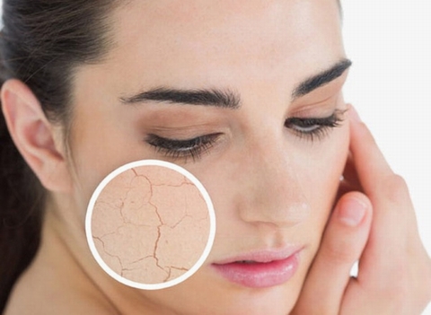 Mẹo nhỏ ngăn ngừa da &quot;nứt nẻ&quot; trong mùa đông