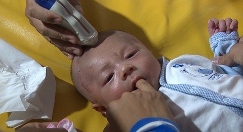 Các bác sĩ siêu âm phát hiện ổ vi trùng nằm trong não bé Phát. Ảnh: Khánh Trung.