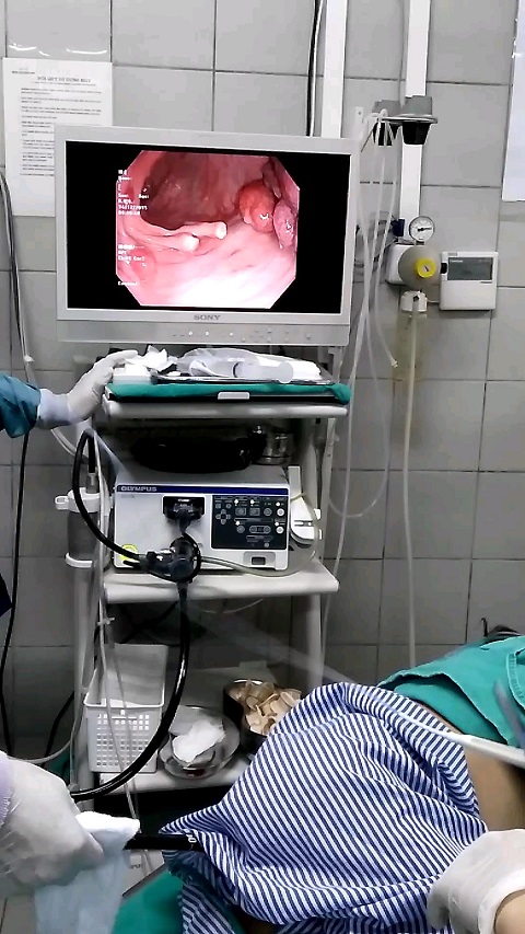 Các bác sỹ đã phải dùng 06 kẹp clip và 02 thòng lọng endoloop để cầm máu cho bệnh nhân.