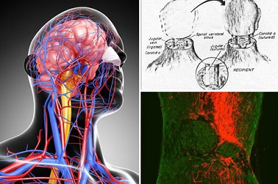 Năm 2017: Việt Nam sẽ tiến hành ca ghép đầu người đầu tiên