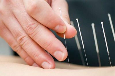 Có nên châm cứu cho trẻ nhỏ?