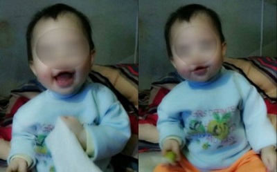 Bệnh nhi 8 tháng tuổi tử vong bất thường ở bệnh viện