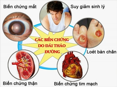 Bài thuốc trị đái tháo đường