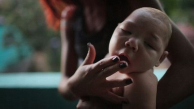 Khuyến cáo phụ nữ hoãn mang bầu vì e ngại Virus gây teo não