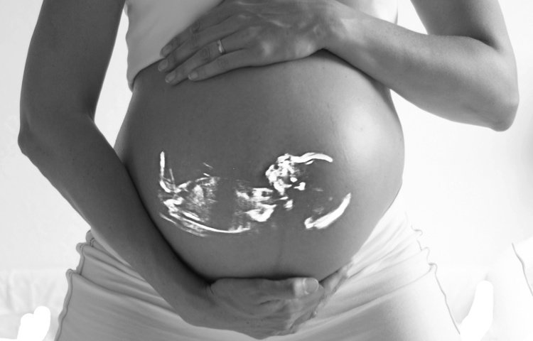 Thai phụ và thai nhi có thể gặp nguy hiểm nếu nhiễm virus Zika.